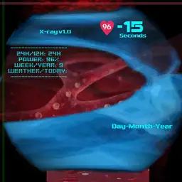 Blood and bones X-ray scan 2