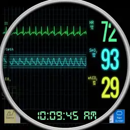 ECG Watch