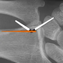 X-Ray