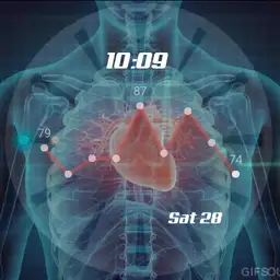 MY HEART WATCH