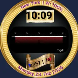 Xdrip watch 14