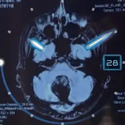 My Brain