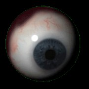 Eye