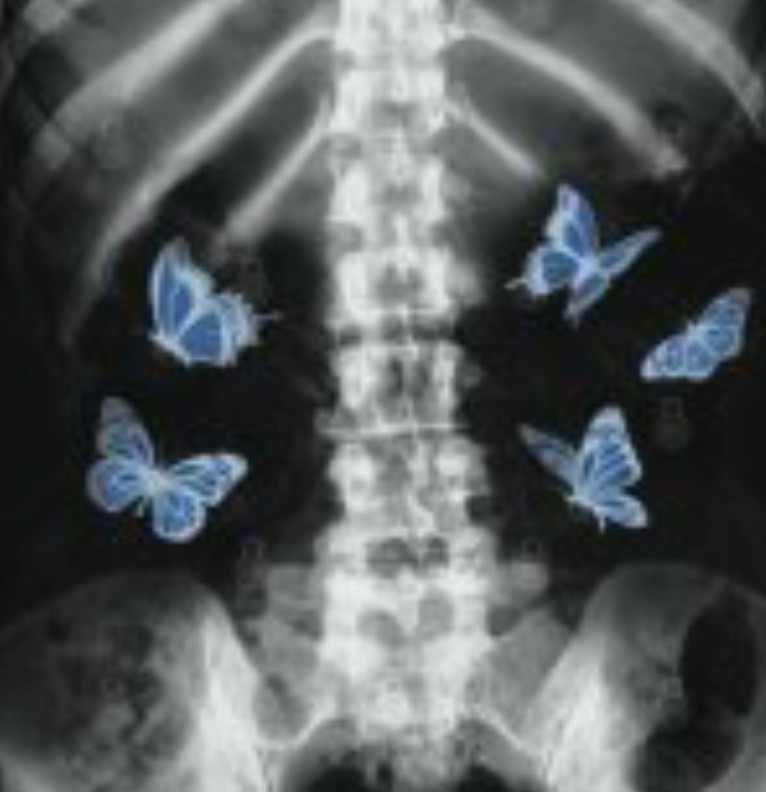 butterfly effect