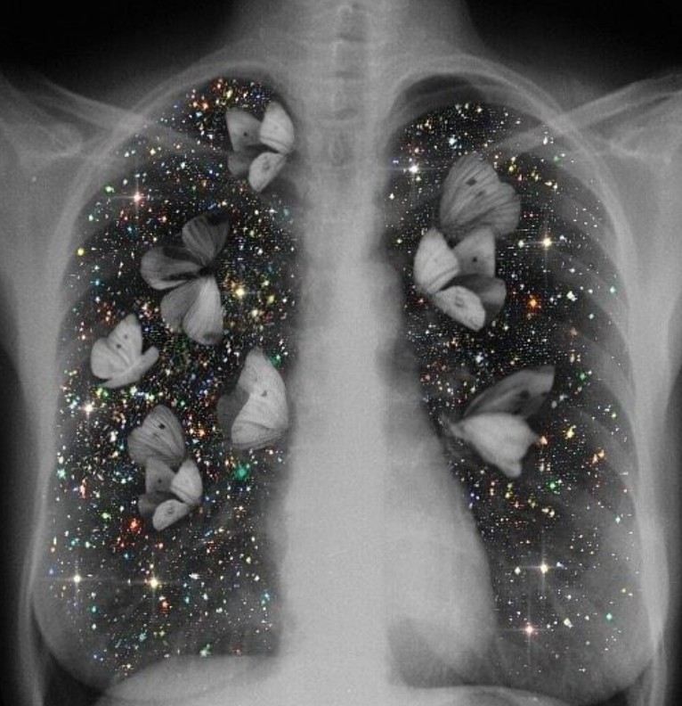 butterflys