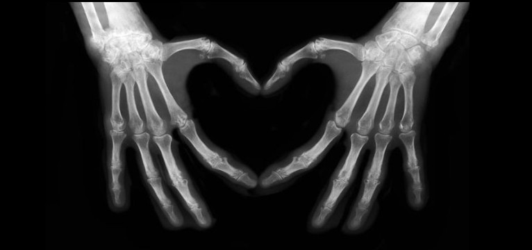 Corazn con esqueleto