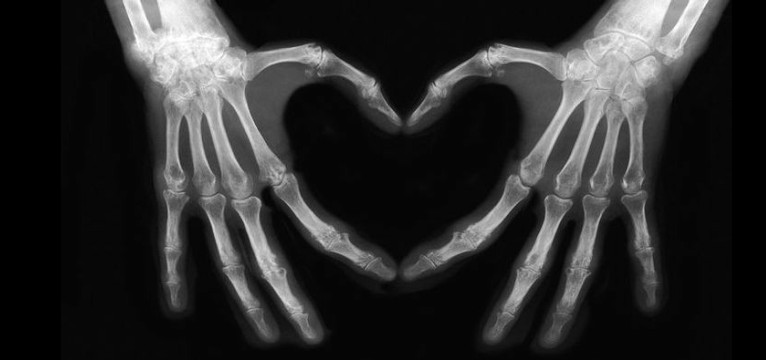 skeleton 