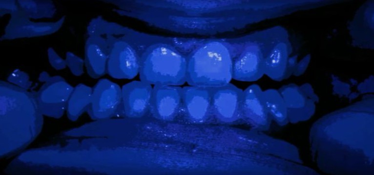 blue teeth