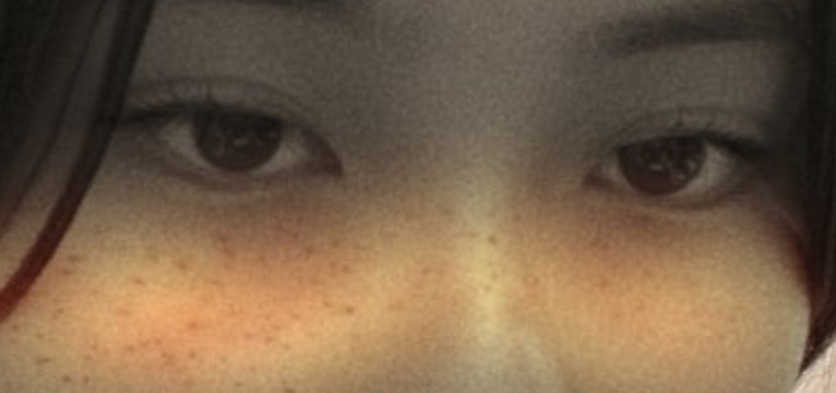 eyes