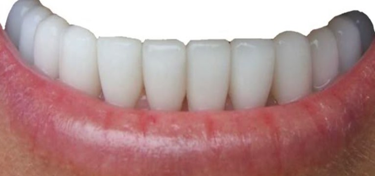 mouth #2
