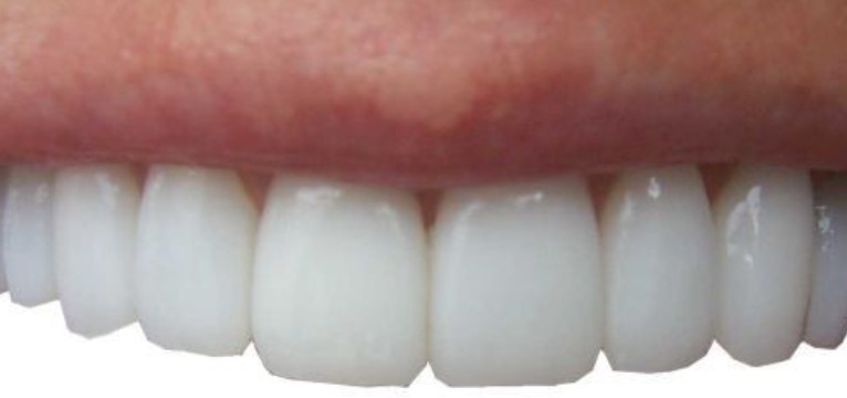 mouth #1