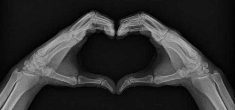 Black, love