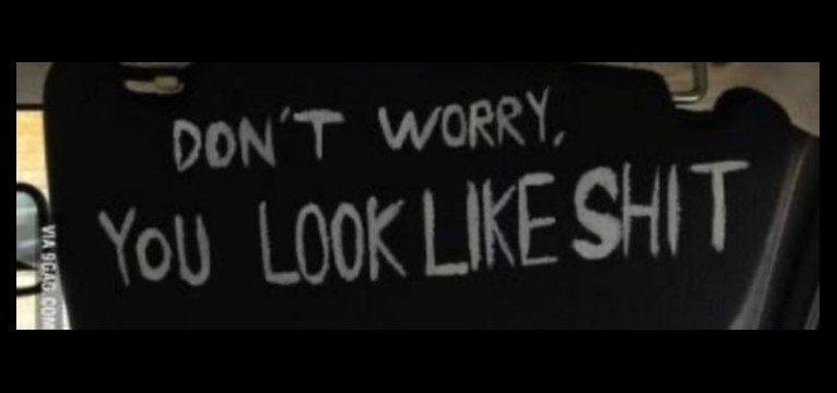 dont worry 