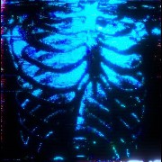 Ribcage