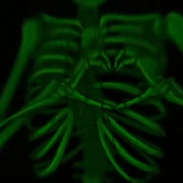 skelly