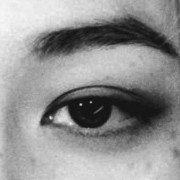 Felix eye
