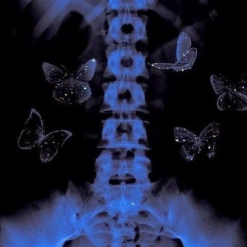 black butterfly stomache