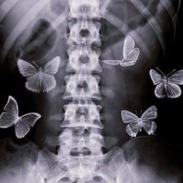 butterfly